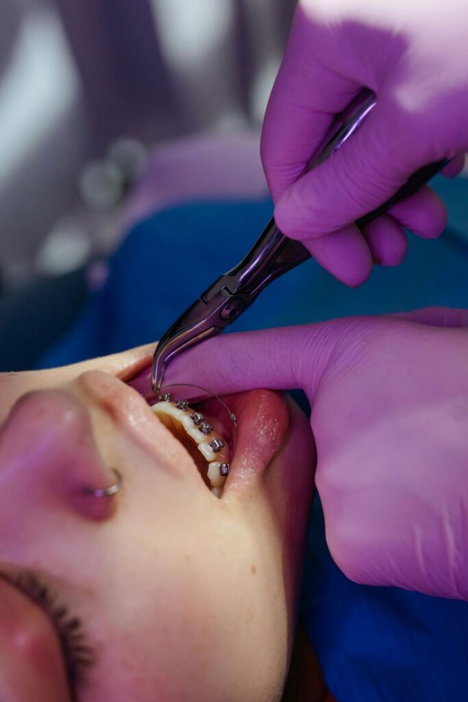dentysta 8 Ile trwa wyrywanie zęba stałego i od czego to zależy